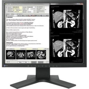 19IN CLR TFT LCD DICOM CALIBRATION - MX194-BK