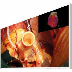 Eizo 43IN ULTRA HD 4K MEDICAL GRADE TFT LED MNTR 16:9 3840X2160 1000:1 EX4342