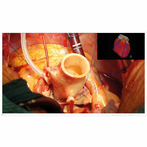 Eizo 43IN ULTRA HD 4K MEDICAL GRADE TFT LED MNTR 16:9 3840X2160 1000:1 EX4342 - Image 2